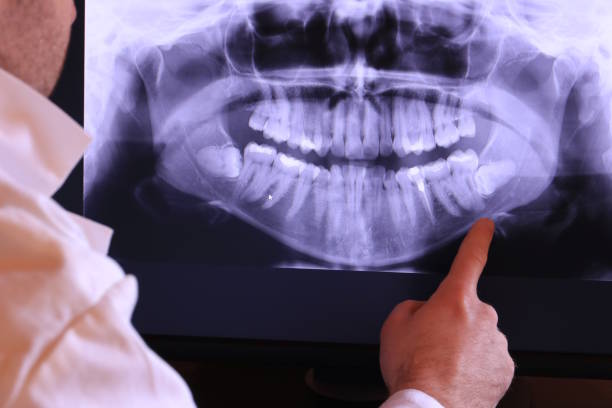 Best Emergency Treatment for Toothache in Keizer, OR