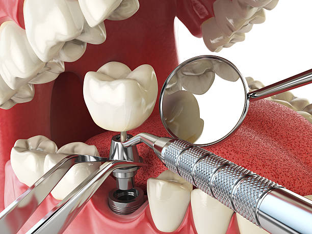 Best Emergency Broken Tooth Repair in Keizer, OR
